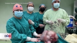 Extraen tumor gigante a embarazada en Guatemala