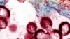HIV virions budding and releasing from an infected cell