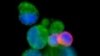 Spray Detects Hard-to-Find Tumors