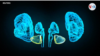 Neuronas al servicio del reconocimiento facial