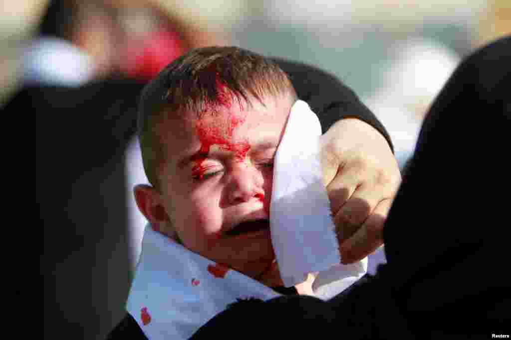 Seorang anak Muslim Syiah menangis saat kepalanya berdarah, sebagai bagian dari prosesi keagamaan memperingati hari Asyura (Ashoura) di Nabatiyeh, Lebanon selatan.