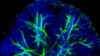 Scientists Find Key to Regenerating Salivary Glands