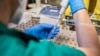 ILUSTRACIJA - Naučnik u laboratoriji (Foto: Institut za javno zdravlje Crne Gore) 